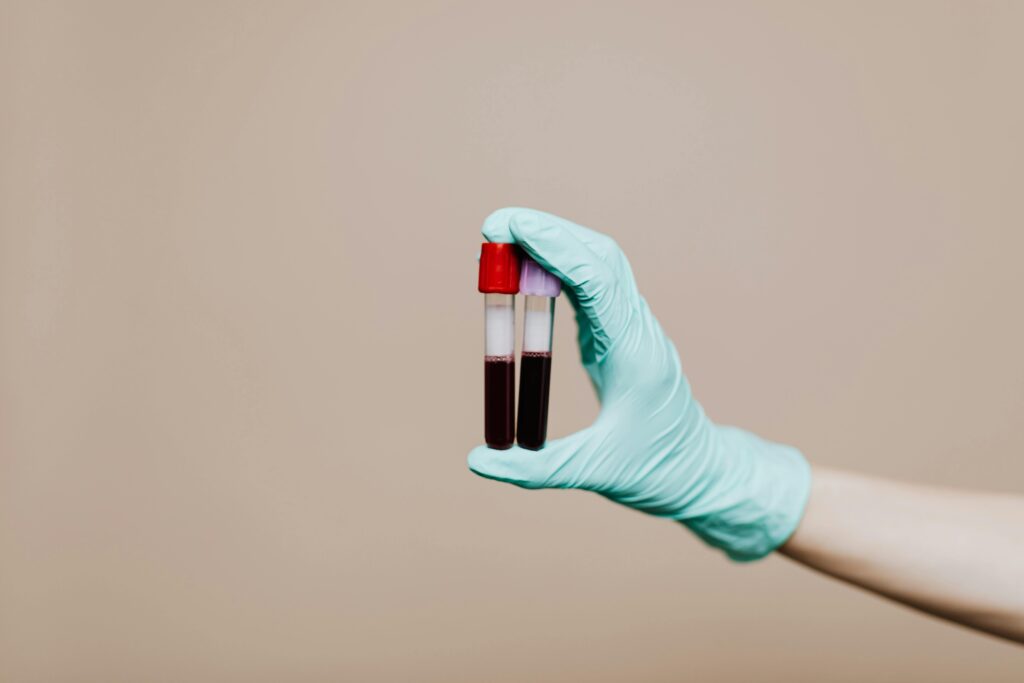 Why Functional Medicine Looks Beyond the Symptoms
If you’ve ever felt like something was “off” in your body—yet every test came back normal—you’re not alone. Many people experience chronic symptoms like fatigue, bloating, anxiety, hormonal imbalances, or stubborn weight gain without getting clear answers from conventional medicine. That’s where functional medicine comes in.